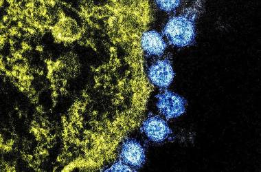 Corona COVID-19 Virus Update 12/03/2020 Corona COVID-19 Virus Update 12/03/2020