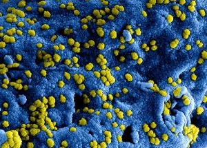 University Makes Contingency Plans should Corona Situation Escalate